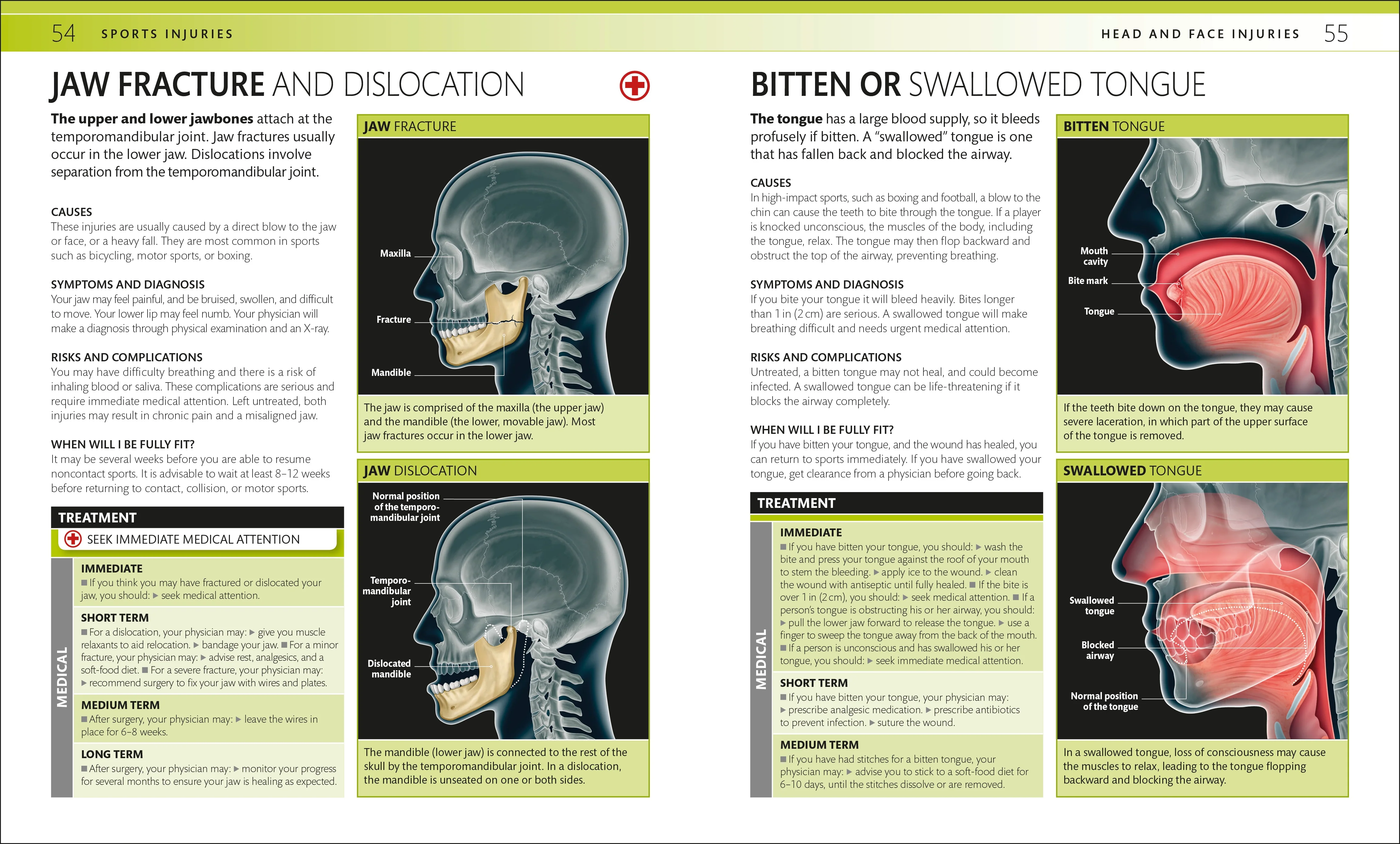 Everyday Sports Injuries - Image 4